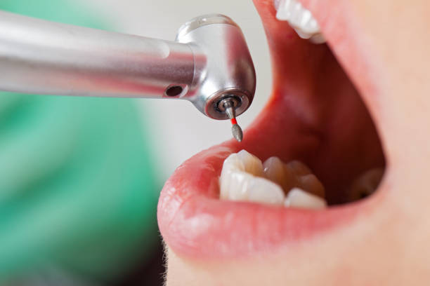 Best Pediatric Emergency Dentist in Piedmont, CA